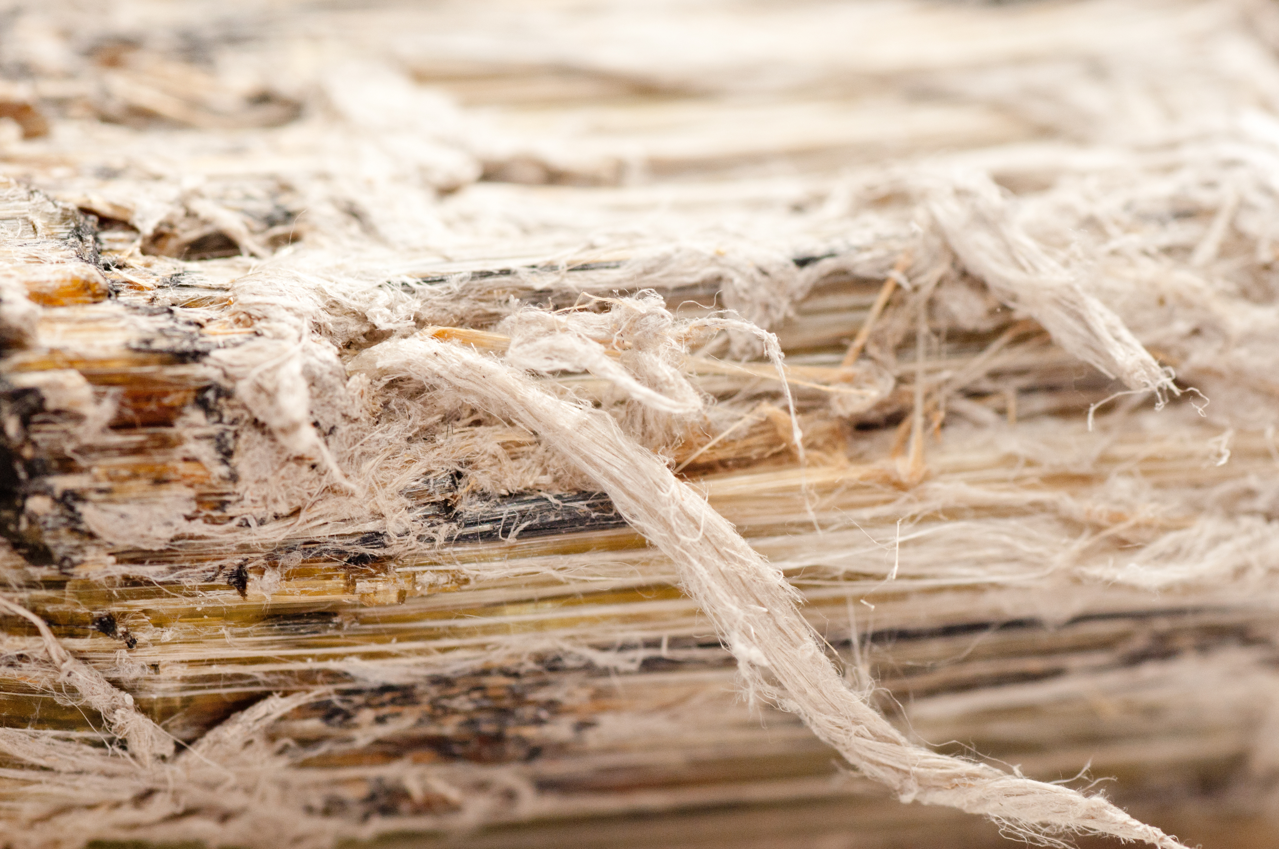 An image of asbestos fibers which can lead to epithelioid mesothelioma.